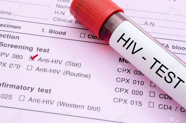 HIV test